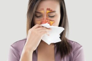 triệu chứng viêm xoang nặng
